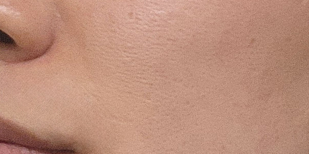 After using SARANG serum