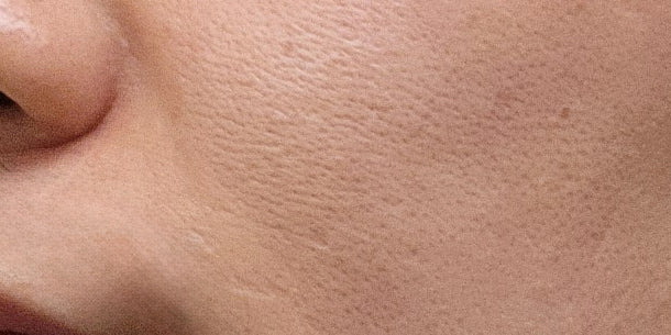 Before using SARANG serum